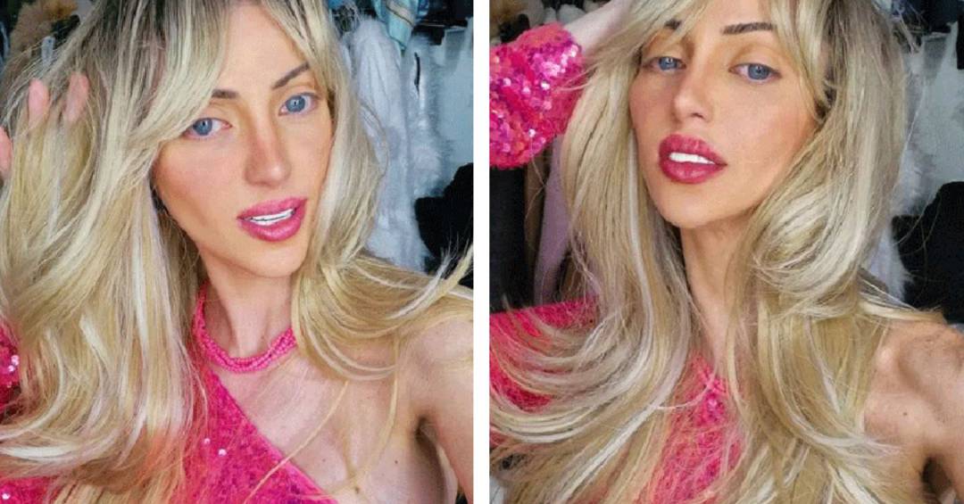 Laudo Pericial Confirma Overdose de Cocaína na Morte da Influenciadora Conhecida como 'Barbie Humana'