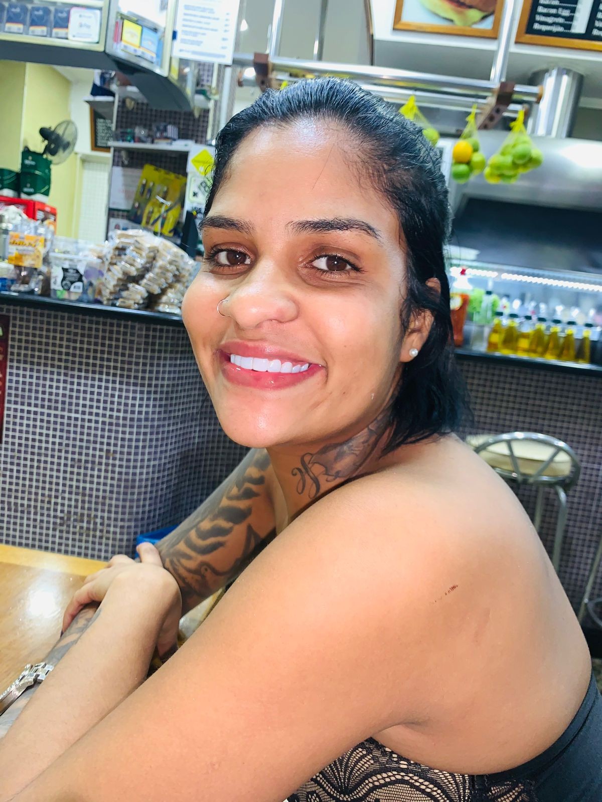 Mulher Amputada Após Atropelamento Brutal Enfrenta Quarta Cirurgia: Família Lida com Trauma e Desinformação